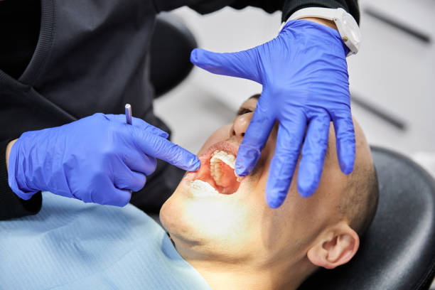 Best Broken or Chipped Tooth Repair in Madison, NJ